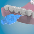 Caring for Teeth with Dental Implants: A Guide to Oral Hygiene