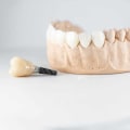What are the Main Reasons for Dental Implant Failure?